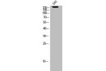 Western Blot analysis of 293 cells using BRCA1 Polyclonal Antibody