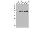 Western blot analysis of HEPG2 293T-UV HELA AD293 HELA-UV using Acetyl-p53 (K381) Polyclonal Antibody.