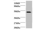 Western blot<br />
All lanes: Protein canopy homolog 2 antibody at 2ug/ml+293T whole cell lysate<br />
Secondary<br />
Goat polyclonal to Rabbit IgG at 1/15000 dilution<br />
Predicted band size: 21,10 kDa<br />
Observed band size: 47 kDa<br />