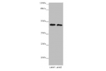 Western blot<br />
All lanes: BTBD2 antibody at 6ug/ml<br />
Lane 1 : 293T whole cell lysate<br />
Lane 2 : Hela whole cell lysate<br />
Secondary<br />
Goat polyclonal to rabbit IgG at 1/10000 dilution<br />
Predicted band size: 56,23 kDa<br />
Observed 