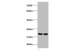 Western blot<br />
All lanes: Rho guanine nucleotide exchange factor 18 antibody at 2ug/ml<br />
Lane 1 : EC109whole cell lysate<br />
Lane 2 : 293T whole cell lysate<br />
Secondary<br />
Goat polyclonal to Rabbit IgG at 1/15000 dilution<br />
Predicted 