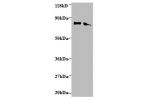 All lanes: Endoplasmic reticulum resident protein 29 antibody at 2ug/ml<br />
Lane 1 : EC109whole cell lysate<br />
Lane 2 : 293T whole cell lysate<br />
Secondary<br />
Goat polyclonal to Rabbit IgG at 1/15000 dilution<br />
Predicted band size: 29,6 kDa