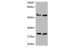 All lanes: Endoplasmic reticulum resident protein 29 antibody at 2ug/ml<br />
Lane 1 : EC109 whole cell lysate<br />
Lane 2 : 293T whole cell lysate<br />
Secondary<br />
Goat polyclonal to Rabbit IgG at 1/15000 dilution<br />
Predicted band size: 29,6 kD