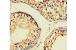 Immunohistochemistry of paraffin-embedded human
