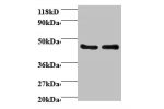 All lanes: Activator of 90 kDa heat shock protein ATPase homolog 1 antibody at 2ug/ml<br />
Lane 1 : EC109 whole cell lysate<br />
Lane 2 : 293T whole cell lysate<br />
Secondary<br />
Goat polyclonal to Rabbit IgG at 1/15000 dilution<br />
Predicted band