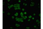 Immunofluorescent analysis of HepG2 cells using CSB-PA05559A0Rb at a dilution of 1:100 and Alexa Fluor 488-congugated AffiniPure Goat Anti-Rabbit IgG(H+L)