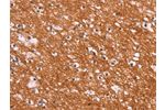 The image on the left is immunohistochemistry of paraffin-embedded Human brain tissue using CSB-PA055939(ENDOG Antibody) at dilution 1/15, on the right is treated with synthetic peptide. (Original magnification: 