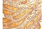 Immunohistochemistry of paraffin-embedded human small intestine tissue using CSB-PA05659A0Rb at dilution of 1:100