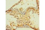 Immunohistochemistry of paraffin-embedded human testis tissue using CSB-PA05699A0RB at dilution 1:100