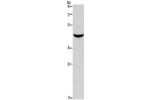 Gel: 10%SDS-PAGE, Lysate: 40 