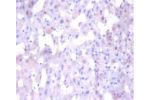 Immunohistochemistry of paraffin-embedded human liver tissue using CSB-PA05729A0Rb at dilution 1:100