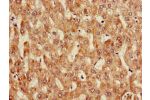 Immunohistochemistry of paraffin-embedded human liver tissue using CSB-PA05759A0Rb at dilution of 1:100