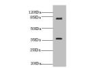 Western blot<br />
All lanes:BDNF antibody at 16ug/ml+U251 whole cell lysate<br />
Secondary<br />
Goat polyclonal to rabbit at 1/10000 dilution<br />
Predicted band size: 28,29,30,38,32 kDa<br />
Observed band size: 37 kDa,80 kDa<br />