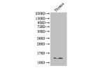 Western Blot<br />
Positive WB detected in: mouse thymus<br />
All lanes: B2M antibody at 4ug/ml<br />
Secondary<br />
Goat polyclonal to rabbit IgG at 1/50000 dilution<br />
Predicted band size: 13kDa<br />
Observed band size: 13 kDa<br />