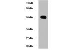 Western blot<br />
All lanes : C-C motif chemokine 2 Antibody at 2ug/ml+EC109 whole cell lysate<br />
at 20 ug<br />
Secondary<br />
Goat polyclonal to Rabbit IgG at 1/15000 dilution<br />
Predicted band size: 11kDa<br />
Observed band size: 50 kDa<br />