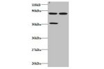 Western blot<br />
All lanes: C-C motif chemokine 22 antibody at 2ug/ml<br />
Lane 1 : 293T whole cell lysate<br />
Lane 2 : EC109 whole cell lysate<br />
Secondary<br />
Goat polyclonal to Rabbit IgG at 1/15000 dilution<br />
Predicted band size: 10 kDa<