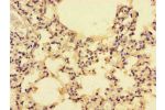 Immunohistochemistry of paraffin-embedded human lung tissue using CSB-PA05949A0Rb at dilution of 1:100