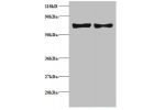 Western blot<br />
All lanes: C-C motif chemokine 5 antibody at 2ug/ml<br />
Lane 1 : EC109 whole cell lysate<br />
Lane 2 : 293T whole cell lysate<br />
Secondary<br />
Goat polyclonal to Rabbit IgG at 1/15000 dilution<br />
Predicted band size: 10 kDa<b