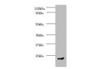 Western blot<br />
All lanes: C-C motif chemokine 5 antibody at 2ug/ml+PMBC whole cell lysate<br />
Secondary<br />
Goat polyclonal to Rabbit IgG at 1/10000 dilution<br />
Predicted band size: 10kDa<br />
Observed band size: 10kDa<br />