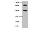 Western blot<br />
C-C motif chemokine 7 Antibody at 2ug/ml+293T whole cell lysate<br />
Secondary<br />
Goat polyclonal to Rabbit IgG at 1/15000 dilution<br />
Predicted band size: 11 kDa<br />
Observed band size: 48kDa<br />
Additional bands at : 90kDa<