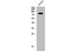 Western Blot analysis of Jurkat cells using Ezrin Polyclonal Antibody