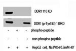 Western Blot analysis of HepG2+NA3VO4 cells using DDR1 Polyclonal Antibody
