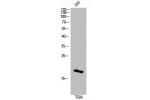 Western Blot analysis of 3T3 cells using Acetyl-Histone H3 (K14) Polyclonal Antibody