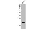 Western blot analysis of SH-SY5Y lysis using Acetyl-Histone H3 (K18) antibody.