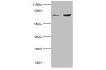 Western blot<br />
All lanes:ACSL4 antibody at 2ug/ml<br />
Lane 1:HepG2 whole cell lysate<br />
Lane 2:Hela whole cell lysate<br />
Secondary<br />
Goat polyclonal to rabbit at 1/10000 dilution<br />
Predicted band size: 80,75 kDa<br />
Observed band siz