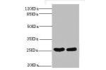 Western blot<br />
All lanes: C-reactive protein antibody at 2ug/ml+High values of serum<br />
Lane 1 : High values of serum at 1:5
Lane 2 : High values of serum at 1:10
Secondary<br />
Goat polyclonal to Rabbit IgG at 1/10000 dilution<br />
Predicted ban