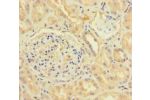 Immunohistochemistry of paraffin-embedded human kidney tissue using CSB-PA06087A0Rb at dilution of 1:100