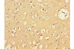 Immunohistochemistry of paraffin-embedded human brain tissue using CSB-PA06119A0Rb at dilution of 1:100