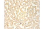 Immunohistochemistry of paraffin-embedded human liver using CSB-PA06139A0Rb at dilution 1:100