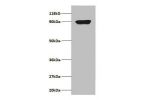 Western blot<br />
C-X-C motif chemokine 5 Antibody at 2ug/ml+293T whole cell lysate<br />
Secondary<br />
Goat polyclonal to Rabbit IgG at 1/15000 dilution<br />
Predicted band size: 12.5 kDa<br />
Observed band size: 90 kDa<br />