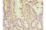 Immunohistochemistry of paraffin-embedded human small intestine tissue using CSB-PA06169A0Rb at dilution of 1:100