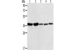 Gel: 10%SDS-PAGE, Lysate: 40 
