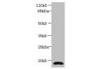 Western blot<br />
All lanes : Anti-Cystatin C antibody at 2ug/ml+ human positive serumSecondary<br />
Goat polyclonal to Rabbit IgG at 1/15000 dilution<br />
Predicted band size: 16 kDa<br />
Observed band size: 16 kDa<br />