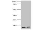 Western blot<br />
All lanes: CST3 antibody at 2ug/ml<br />
Lane 1 : High values of serum at 1:10<br />
Lane 2 : High values of serum at 1:100<br />
Secondary<br />
Goat polyclonal to Rabbit IgG at 1/10000 dilution<br />
Predicted band size: 16kDa<br />
O