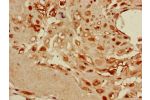 Immunohistochemistry of paraffin-embedded human placenta tissue using CSB-PA06219A0Rb at dilution of 1:100