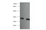 Western blot<br />
All lanes:Heparin-binding growth factor 2 antibody at 2ug/ml<br />
Lane 1 : EC109 whole cell lysate<br />
Lane 2 : 293T whole cell lysate<br />
Secondary<br />
Goat polyclonal to rabbit IgG at 1/10000 dilution<br />
Predicted band size: