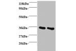 All lanes: Annexin A5 antibody at 2ug/ml<br />
Lane 1 : EC109 whole cell lysate<br />
Lane 2 : 293T whole cell lysate<br />
Secondary<br />
Goat polyclonal to Rabbit IgG at 1/15000 dilution<br />
Predicted band size: 35.5 kDa<br />
Observed band size: 35.