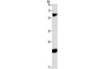 Gel: 10%SDS-PAGE, Lysate: 40 