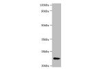 All lanes: Fibroblast growth factor 21 antibody at 2ug/ml+A549 whole cell lysate<br />
Secondary<br />
Goat polyclonal to Rabbit IgG at 1/15000 dilution<br />
Predicted band size: 23 kDa<br />
Observed band size: 23 kDa<br />
Immunohistochemistry