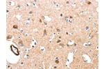 The image on the left is immunohistochemistry of paraffin-embedded Human brain tissue using CSB-PA066208(AARS Antibody) at dilution 1/50, on the right is treated with synthetic peptide. (Original magnification: 