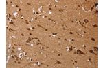 The image on the left is immunohistochemistry of paraffin-embedded Human brain tissue using CSB-PA066402(EDN3 Antibody) at dilution 1/50, on the right is treated with fusion protein. (Original magnification: 