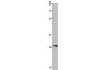 Gel: 8%SDS-PAGE, Lysate: 40 
