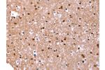 The image on the left is immunohistochemistry of paraffin-embedded Human brain tissue using CSB-PA068354(FAT1 Antibody) at dilution 1/20, on the right is treated with synthetic peptide. (Original magnification: 