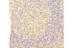 Immunohistochemistry of paraffin-embedded human tonsil tissue using CSB-PA06859A0Rb at dilution 1:100