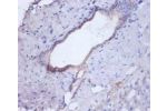 Immunohistochemistry of paraffin-embeded human liver using CSB-PA06974A0Rb at dilution of 1:100