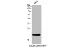Western Blot analysis of K562 insulin 0.01U/ml 15 cells using COX4I2 Polyclonal Antibody.